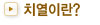 치열이란?