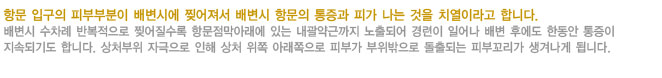 치열이란?