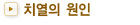 치열의 원인