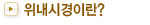 위내시경이란?