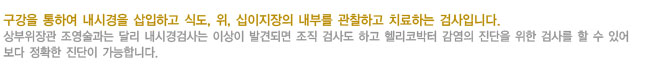 위내시경이란?
